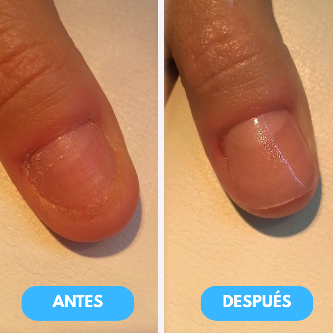 1+1 GRATIS | Rejuvenation™ - Tratamiento nutritivo que fortalece el crecimiento natural de tus uñas