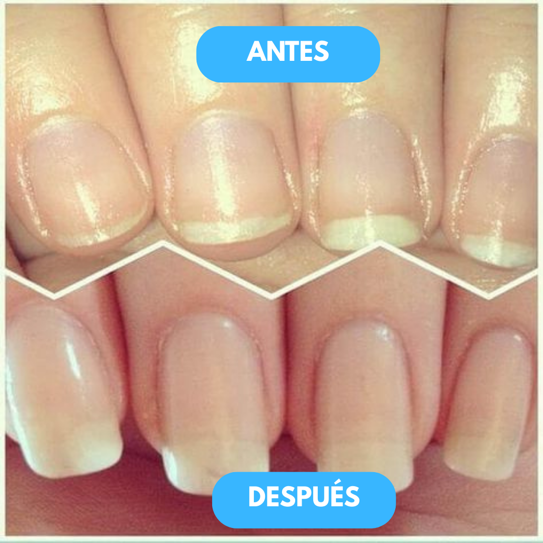 1+1 GRATIS | Rejuvenation™ - Tratamiento nutritivo que fortalece el crecimiento natural de tus uñas