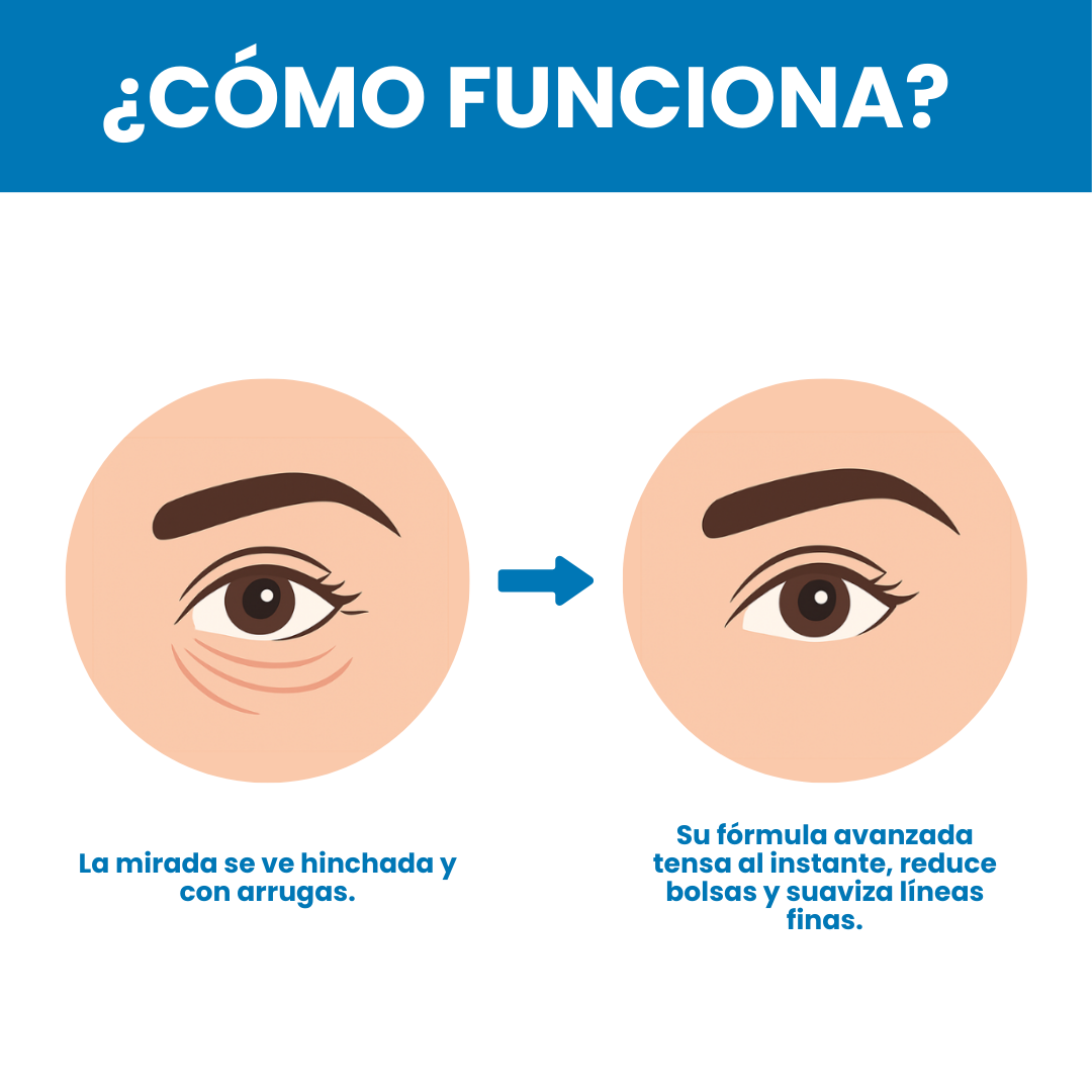 Sovana Peter Thomas™ - 2 Minutos. Cero Bolsas. 10 Años Menos.
