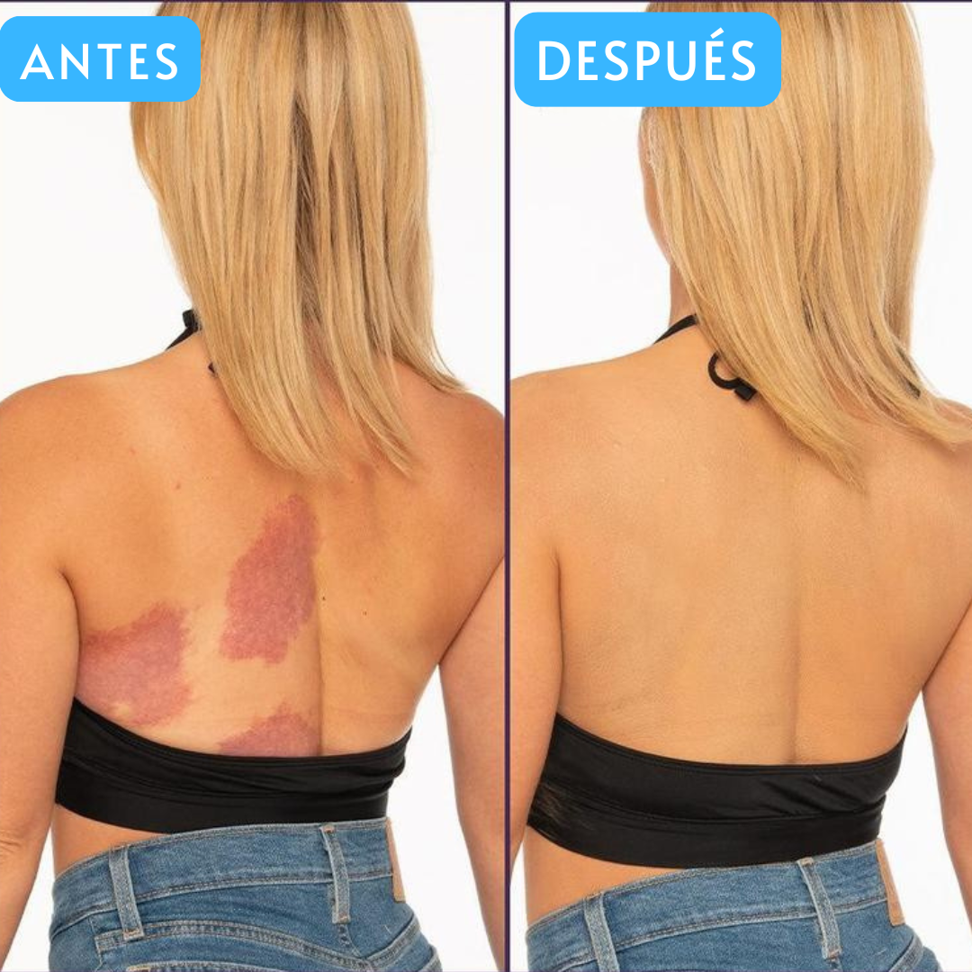 1+1 GRATIS | Westmore Beauty™ - Maquillaje corporal para embellecer tu piel al momento