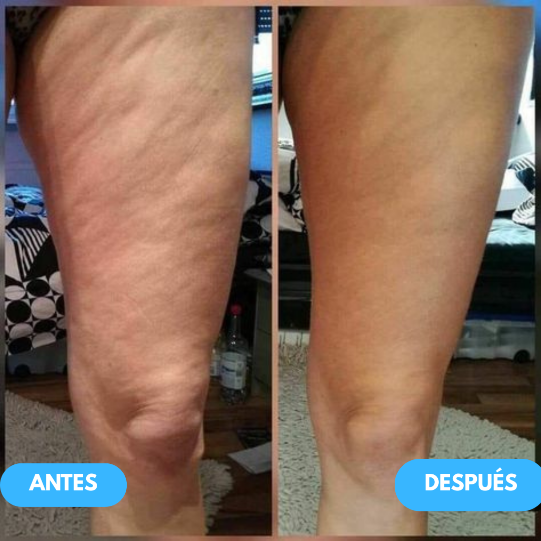 1+1 GRATIS | Get Dreamy™ - Crema reafirmante exprés para piernas