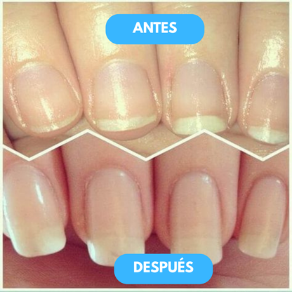 1+1 GRATIS | Rejuvenation™ - Tratamiento nutritivo que fortalece el crecimiento natural de tus uñas