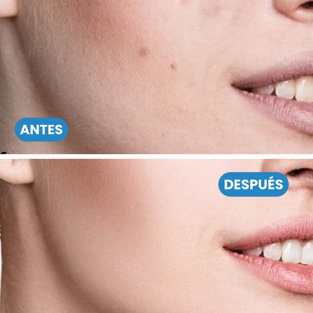 Sovana Sérum Nida - Unifica tu tono de piel y presume de un rostro sin manchas