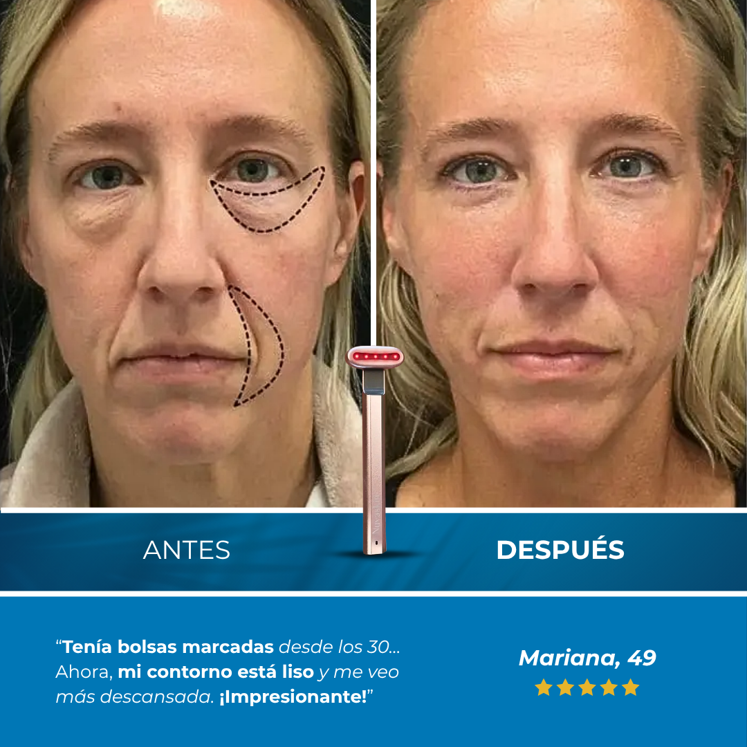 Ritual Sovana - Lápiz de luz roja Anti-Arrugas con sérum activador