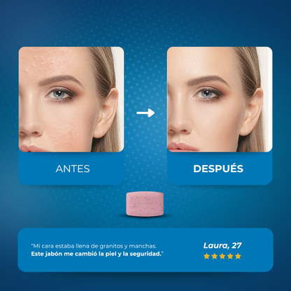 Sovana Revitalex - Jabón exfoliante con ácido salicílico anti-acné