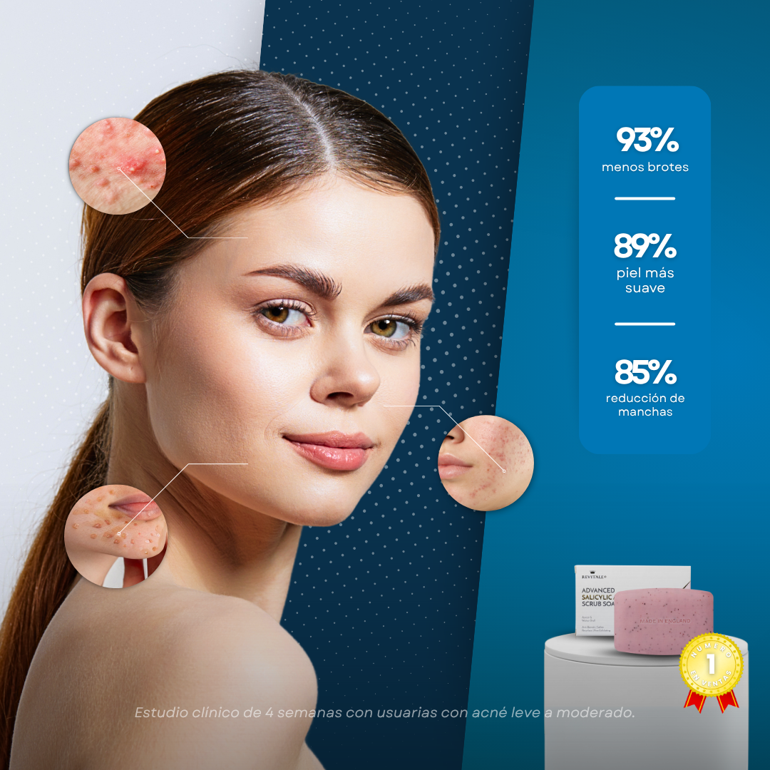 Sovana Revitalex - Jabón exfoliante con ácido salicílico anti-acné