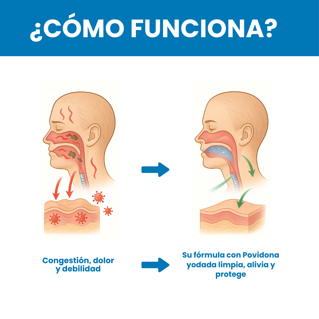 Sovana Viraldine - Aerosol nasall diseñado para el alivio de garganta