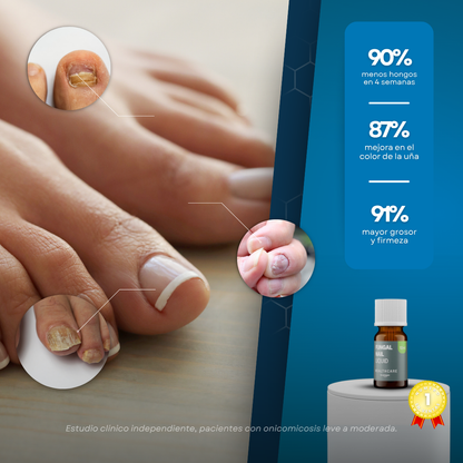 Sanorys Fung - Líquido para eliminar hongos de las uñas