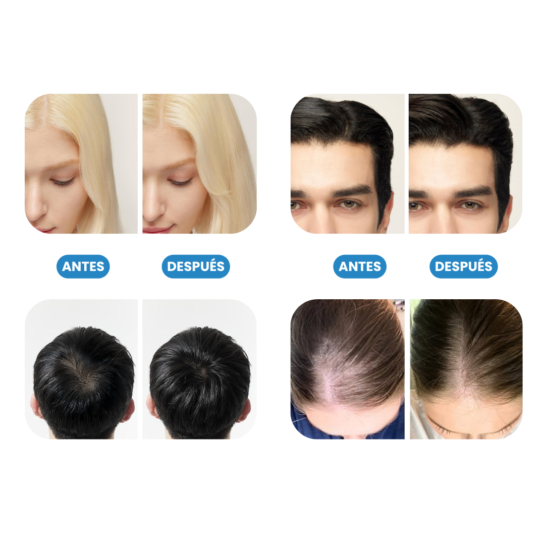 Sovana Dr. Groot- Champú coreano para la pérdida del cabello