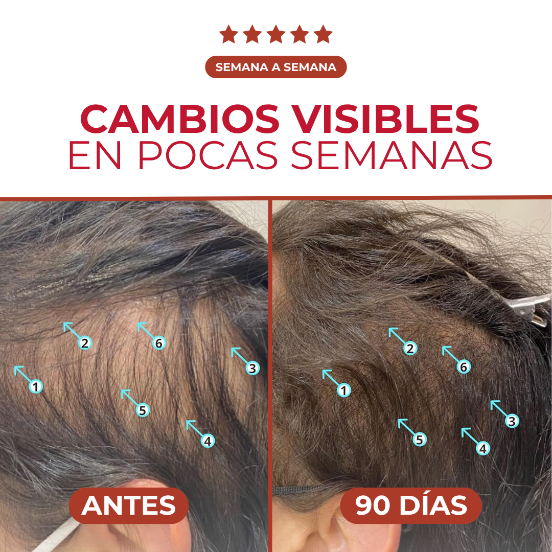 Revita™ - Champú Revitalizador de Densidad Capilar No Invasivo