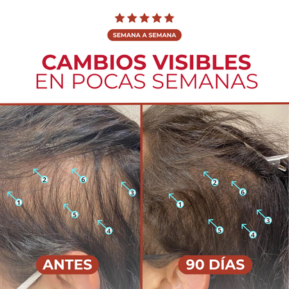 Revita™ - Champú Revitalizador de Densidad Capilar No Invasivo